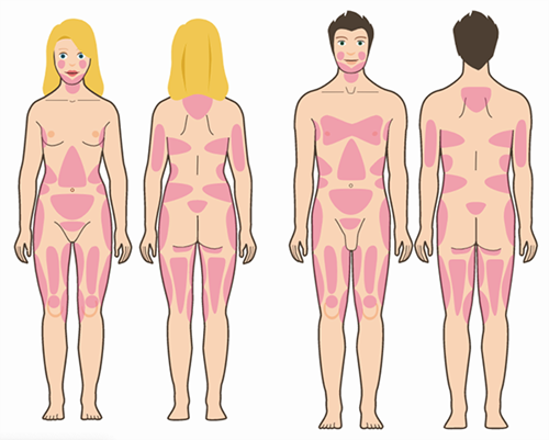 partes-del-cuerpo-tratadas-con-liposucción