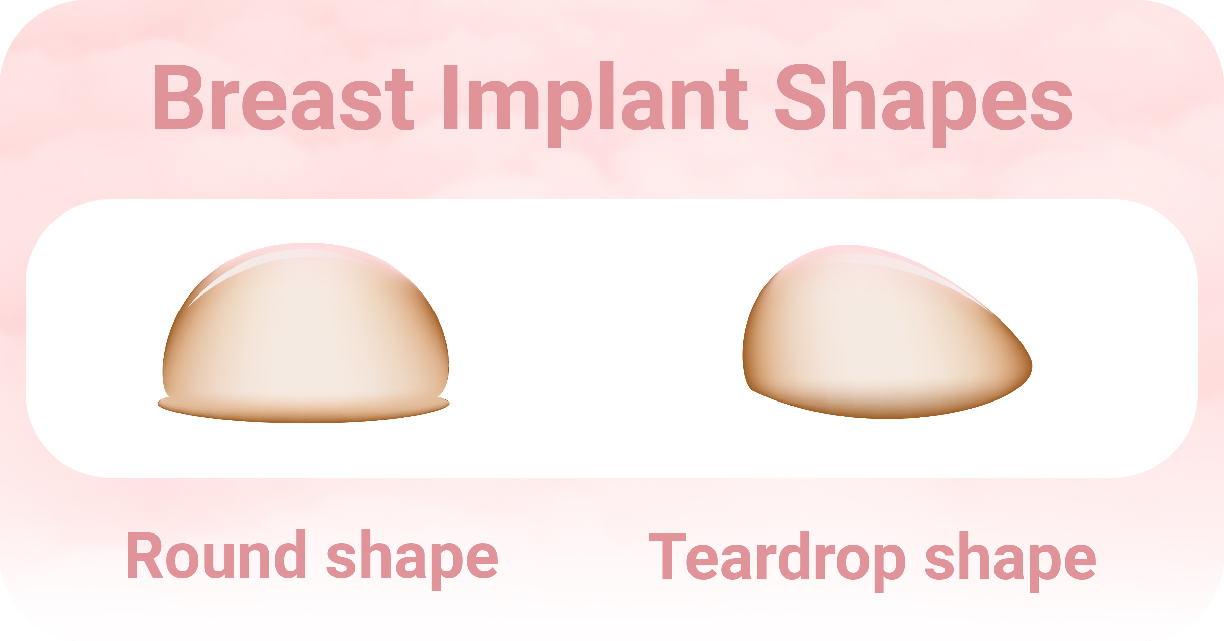 Formas de implantes mamarios 