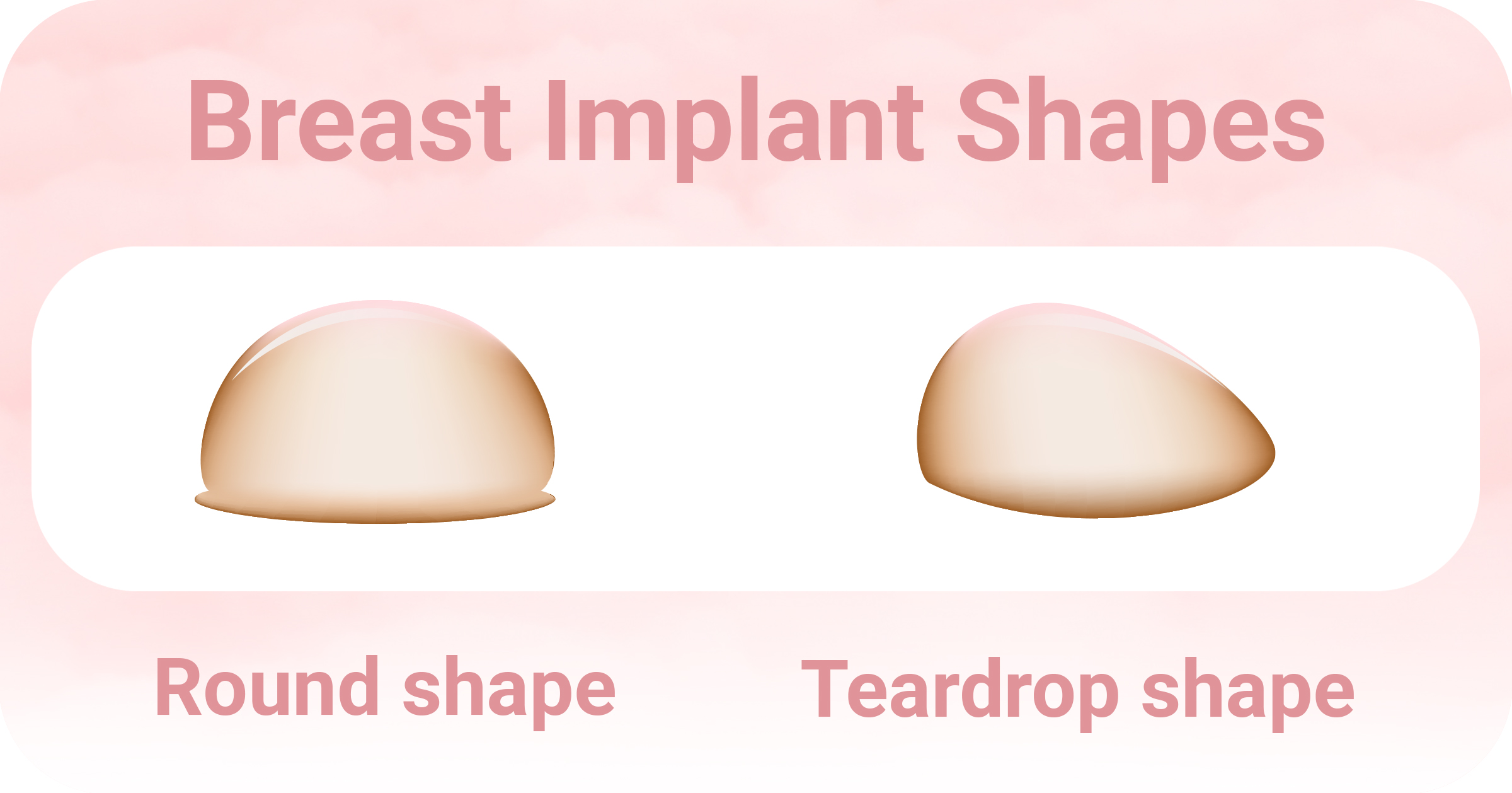 Formas de implantes mamarios
