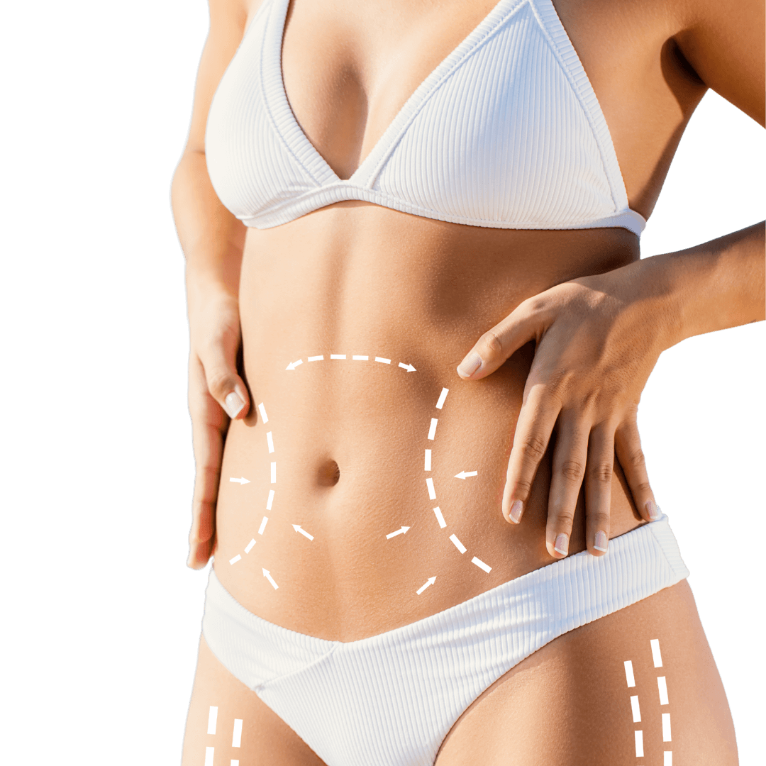 Liposuction - Lipofilling