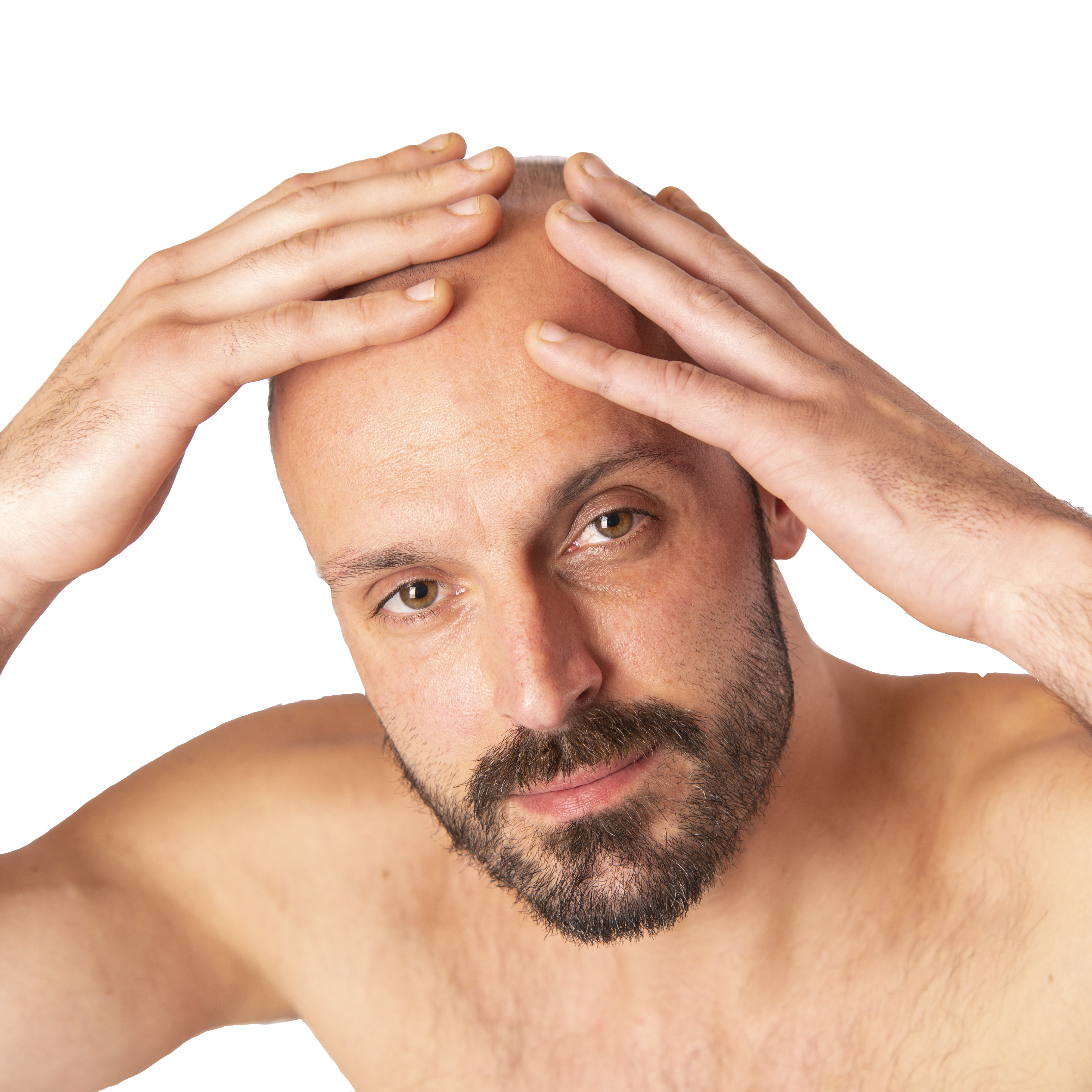 Hair transplant