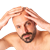 Hair transplant