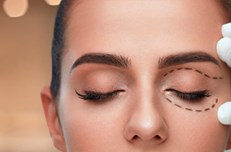 Blefaroplastia