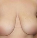 Antes