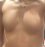 Antes
