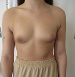 Antes
