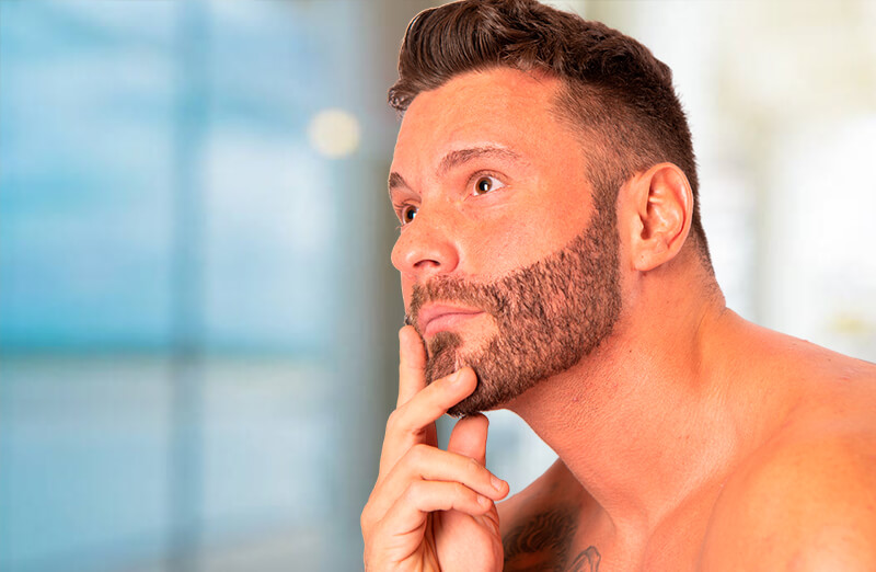 Trasplante de cejas, barba y bigote 