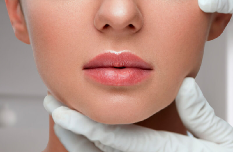 Lipofilling de Labios