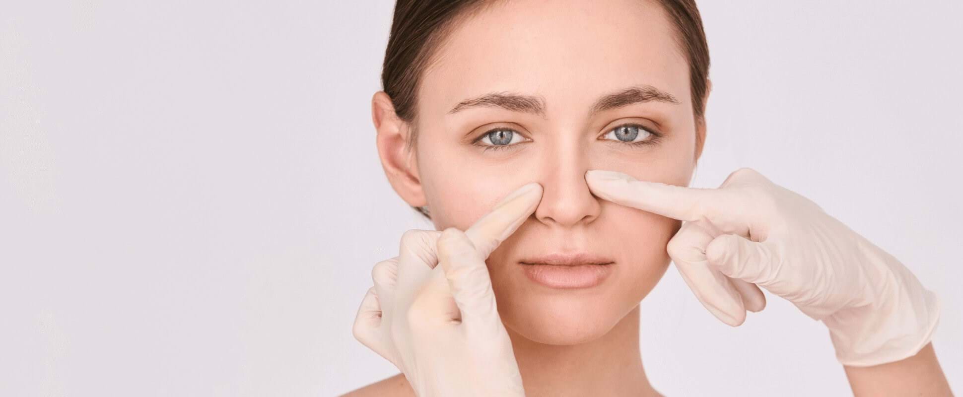 Rinoplastia por punta nasal globulosa - Nuevo artículo en el Blog de Wellness Kliniek Barcelona
