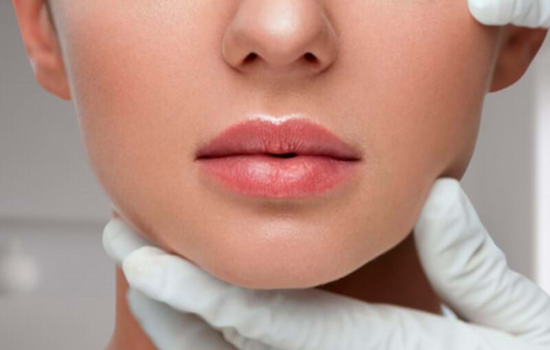 Lipofilling de Labios