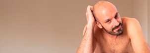 Trasplante capilar hombres