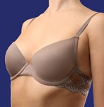 Antes de someterme a una operación de aumento de pecho con implantes talla 265cc XP en Wellness Kliniek Barcelona