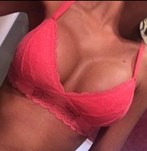 Breast augmentation with implants size 380cc XP at the Wellness Kliniek Barcelona