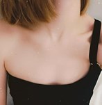 fotos de antes de someterme a una operación de aumento de pecho con implantes talla 300cc XP en Wellness Kliniek Barcelona