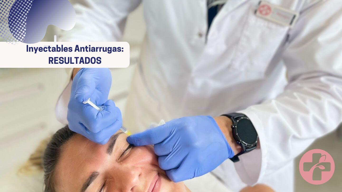 Inyectables antiarrugas en Wellness Kliniek