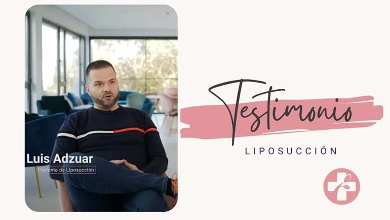 testimonio de un paciente de liposucción en Barcelona