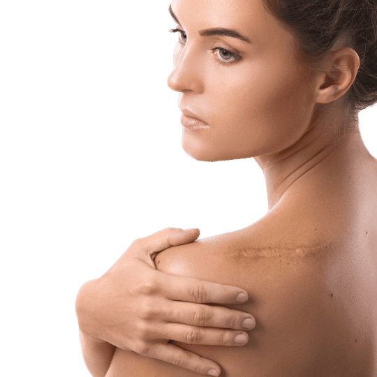Scar Correction