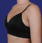 Before breast augmentation operation with size 240cc XXP implants