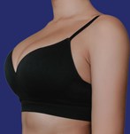 breast augmentation operation with size 240cc XXP implants