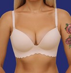 fotos de una operación de aumento de pecho con implantes talla 360cc XP