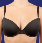 Aumento de una talla con lipofilling mamario