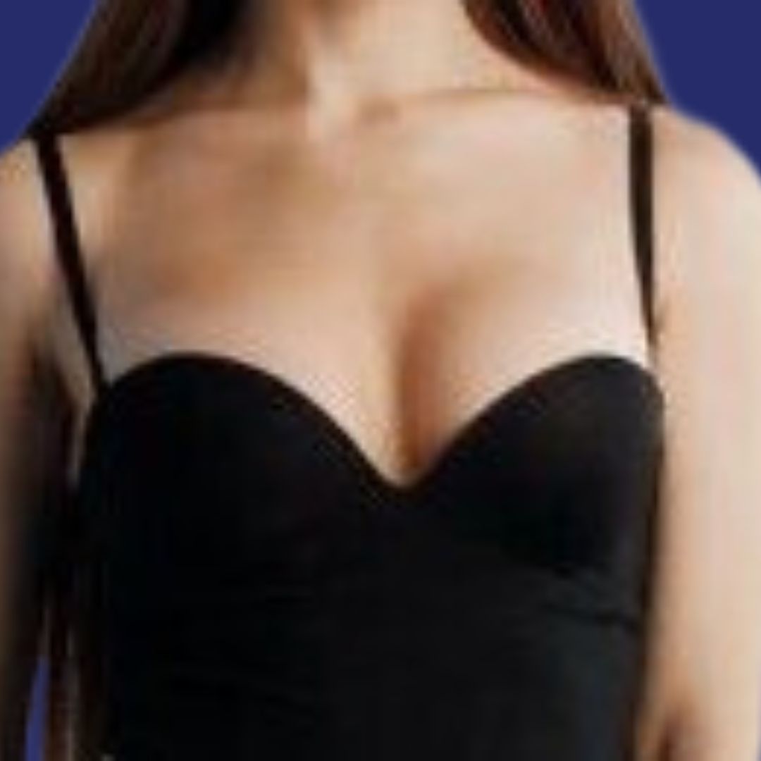 Exchange of prosthesis for larger implants