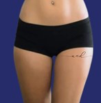 After liposuction legs improvement of inner thigh contour