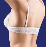 liposucción espalda foto resultado