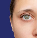 Fotografía de resultados de blefaroplastia