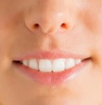 antes aumento de labios con rellenos