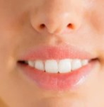 después aumento de labios con rellenos