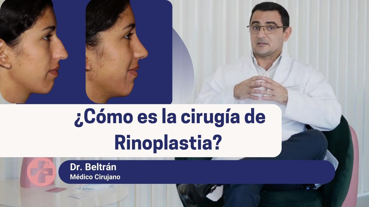 ¿Cómo es una rinoplastia en Barcelona? Explicación del Dr. Beltrán | Wellness Kliniek