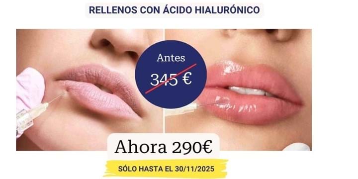 relleno labios con descuento barcelona