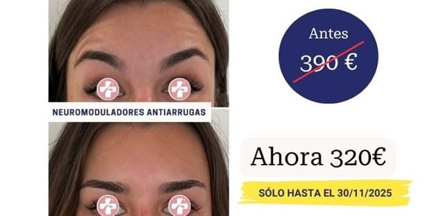 tratamientos antiarrugas con descuento barcelona