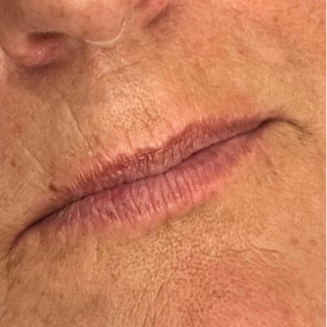 Foto de los labios sin aumento ni contorno marcado.